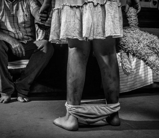 El abuso sexual infantil: el problema mayor