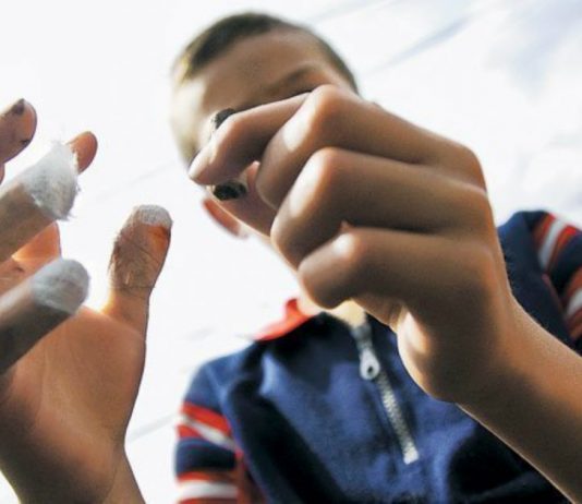 Dos quemados con pólvora en el departamento de Bolívar