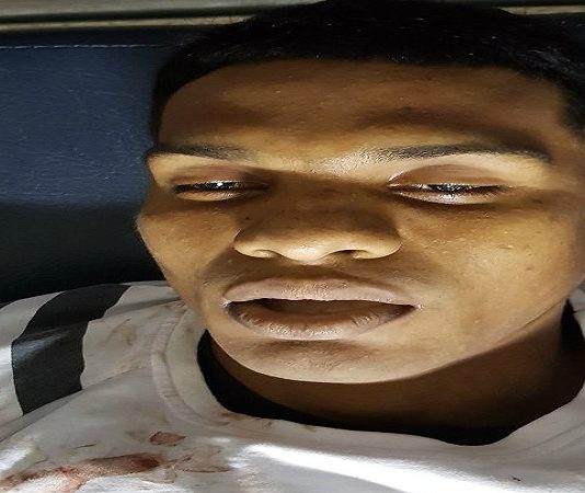 Frustran asesinato de pareja en Cartagena, Sicario Murió apuñalado