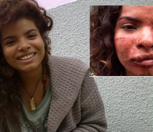 Brutal golpiza recibió una Colombiana en Portugal en acto de discriminación racial Colombiana-agredida-en-Portugal-racismo