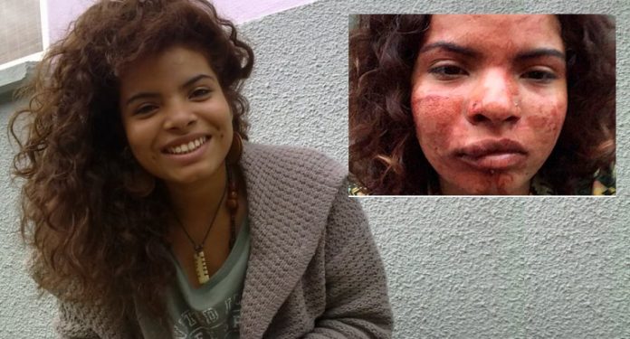 Colombiana-agredida-en-Portugal-racismo